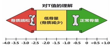 国产绿巨人视频app黄色官方下载仪三大品牌判断骨质变化当T值<-2.5存在低骨量情况